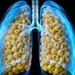 Popcorn Lung and Vaping: What Indonesian Producers Need to Know