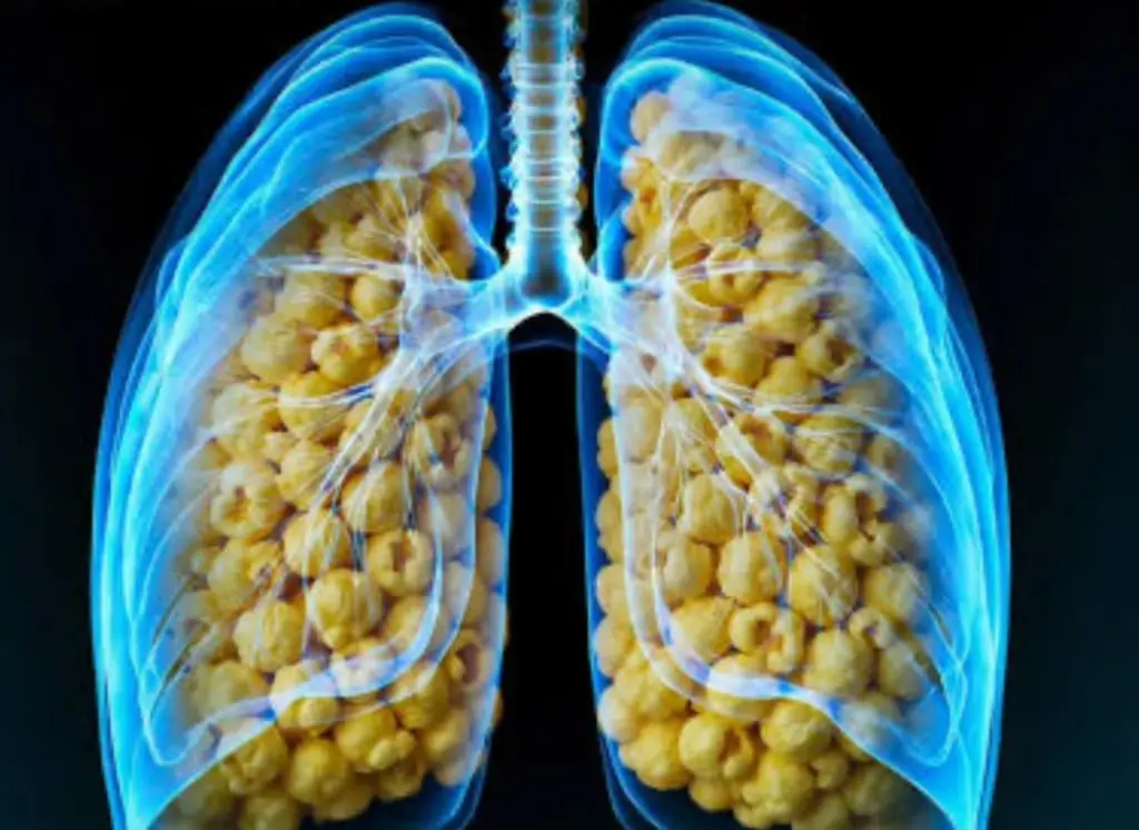 Popcorn Lung and Vaping. What the Science Says